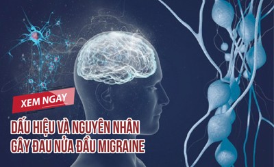 Dấu hiệu và nguyên nhân gây đau nửa đầu migraine - ĐỌC NGAY!