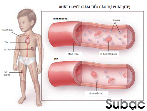 Cách tăng tiểu cầu khi bị sốt xuất huyết và thảo dược giúp cải thiện bệnh hiệu quả