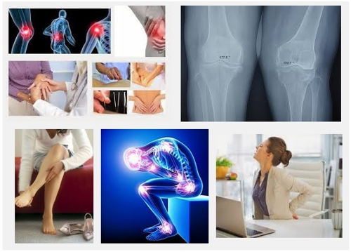 Vì sao ngồi điều hòa thường xuyên sẽ gây đau khớp?