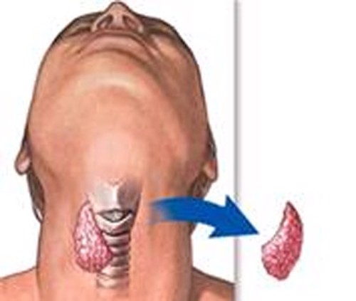 Lời khuyên của chuyên gia giúp phòng ngừa, điều trị bệnh lý tuyến giáp hiệu quả