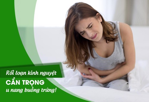 Rối loạn kinh nguyệt - CẨN TRỌNG u nang buồng trứng