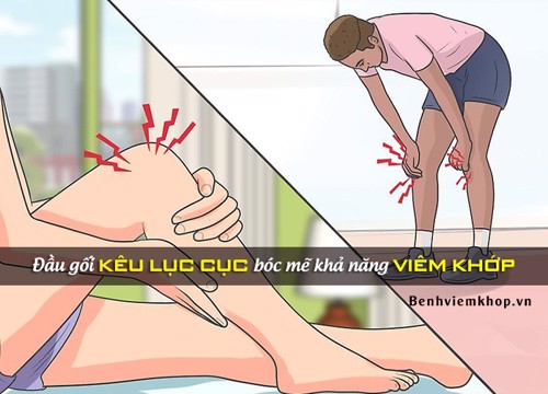 Đầu gối kêu lục cục: BÓC MẼ khả năng viêm khớp