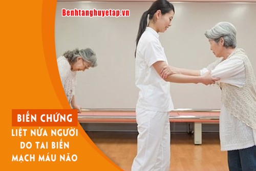 Cẩn trọng với 5 biến chứng do TAI BIẾN MẠCH MÁU NÃO