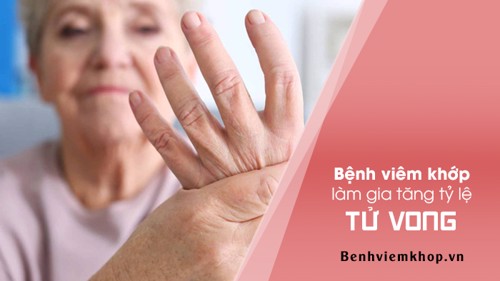 Xanh mặt khi biết có thể MẤT MẠNG vì viêm khớp dạng thấp