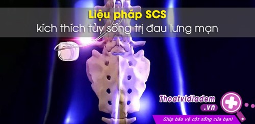 Phương pháp mới kích thích tủy sống: Tin vui cho bệnh nhân đau lưng 