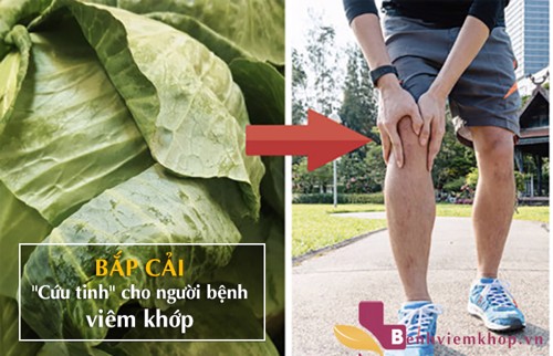 Dân tình sục sôi chuyện cải bắp giúp giảm đau nhức do viêm khớp!