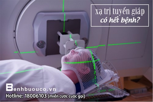 Nghĩ bụng "xạ trị tuyến giáp là hết bệnh". Kết quả khiến bạn KHÓC THÉT! Tại sao vậy?