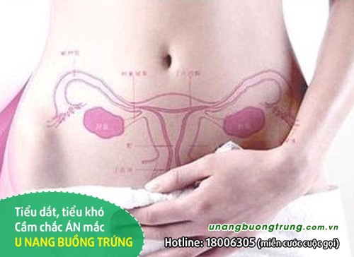 Xuất hiện triệu chứng tiểu khó, tiểu dắt – Cẩn thận U NANG BUỒNG TRỨNG