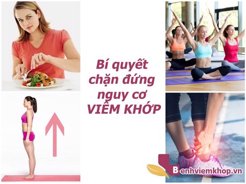 Thực hiện những điều này mỗi ngày sẽ làm GIẢM nguy cơ bị VIÊM KHỚP - Bạn nên THỬ NGAY ĐI!