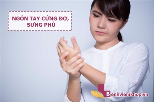 Ngón tay cứng đơ, sưng phù là biểu hiện VIÊM KHỚP bạn không thể bỏ qua