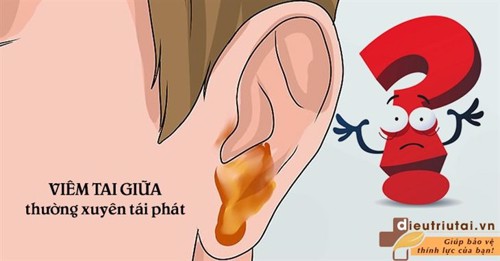 Tại sao VIÊM TAI GIỮA thường xuyên TÁI PHÁT?