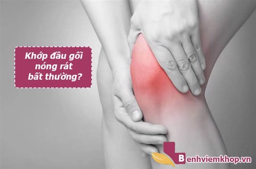 Cẩn trọng VIÊM KHỚP GỐI nếu thấy biểu hiện khớp nóng rát bất thường!
