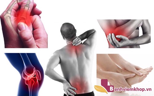 VIÊM XƯƠNG KHỚP thường "nhắm đến" những khớp nào?- Câu hỏi đơn giản nhưng không phải ai cũng biết!