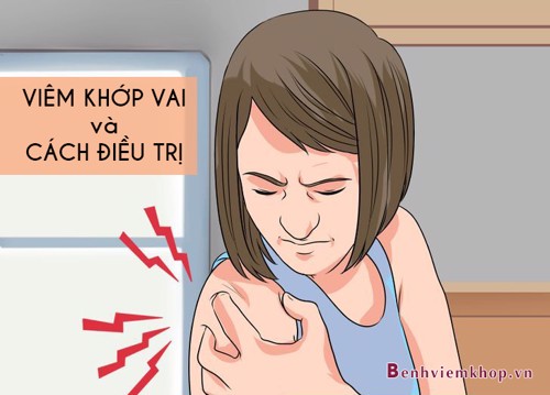 Bệnh viêm khớp vai và cách điều trị dứt điểm theo lời khuyên của chuyên gia