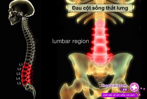 Đau cột sống thắt lưng - Căn bệnh phổ biến của tuổi già