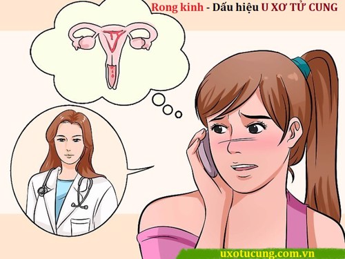 Dấu hiệu nhận biết u xơ tử cung là rong kinh?