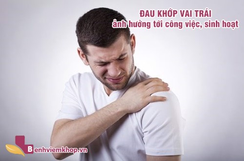 Hướng dẫn cách giảm ĐAU KHỚP VAI TRÁI đơn giản có thể áp dụng tại nhà – XEM NGAY!