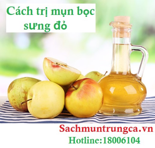  5 cách trị mụn bọc sưng đỏ ở mũi mà không cần nặn!