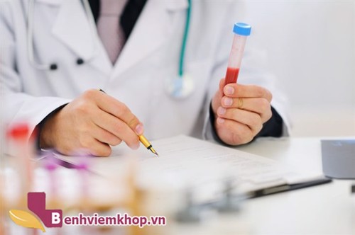 Các xét nghiệm chẩn đoán VIÊM KHỚP DẠNG THẤP là gì? Đọc ngay để biết rõ!