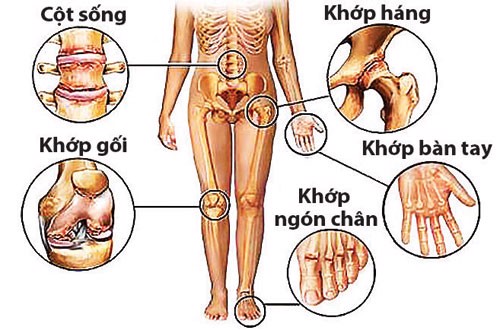 Bị viêm khớp nên ăn gì? TS Mai Thị Minh Tâm tư vấn