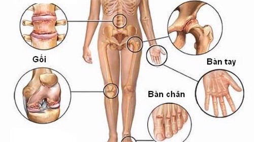 Người bị viêm khớp dạng thấp kiêng ăn gì? Chuyên gia Nguyễn Thị Lực tư vấn