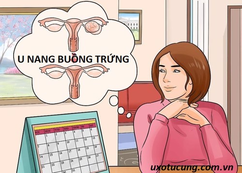 U nang buồng trứng ảnh hưởng ra sao tới sức khỏe và cuộc sống của phụ nữ?