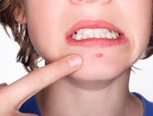 Điều trị đau khớp gối có khó không và bao lâu thì khỏi bệnh? Chuyên gia Mai Thị Minh Tâm giải đáp