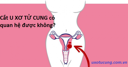 Cắt u xơ tử cung có quan hệ được không? – Câu trả lời hữu ích Ở ĐÂY!