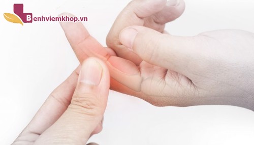      ĐAU KHỚP NGÓN TAY TRỎ - Nguyên nhân và biện pháp khắc phục