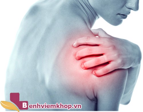 Viêm quanh khớp vai thể đông cứng và những điều bạn nên biết