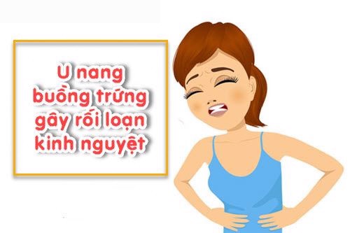 Bị u nang buồng trứng, kinh nguyệt không đều phải làm sao? TS Nguyễn Thị Vân Anh tư vấn