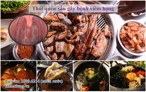 5 thói quen xấu khiến bệnh viêm họng “bám dai như đỉa”