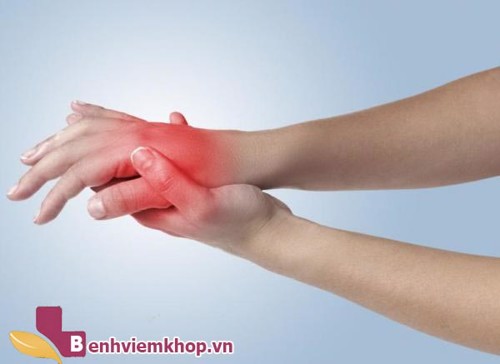 Bị viêm khớp ngón tay cái phải làm sao? – Xem ngay lời khuyên của chuyên gia