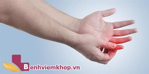 Đau khớp ngón tay út – Tưởng chừng vô hại nhưng lại tiềm ẩn nguy cơ