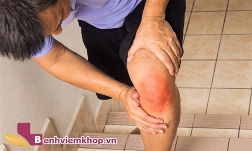 Bệnh VIÊM KHỚP PHẢN ỨNG và những vấn đề cần lưu tâm