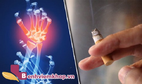 Hút thuốc lá làm tăng nguy cơ mắc bệnh viêm khớp dạng thấp