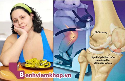 Top 5 điều bạn cần nhớ khi chữa bệnh đau xương khớp. Đọc ngay!