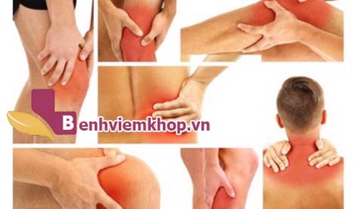 Chữa viêm đa khớp bằng thuốc nam thực hiện như thế nào?