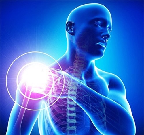 Bị viêm quanh khớp vai, nên điều trị như thế nào? Chuyên gia Nguyễn Thị Lực tư vấn