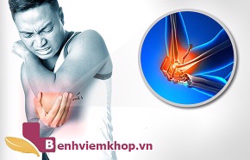 Người bị đau khớp khuỷu tay uống thuốc gì thì tốt?