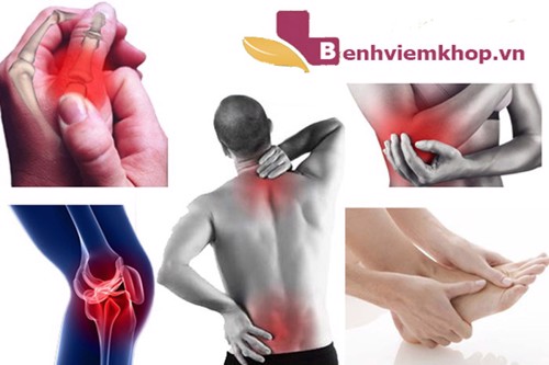 Bệnh viêm đa khớp là gì? Tại sao nên dùng Hoàng Thấp Linh hỗ trợ điều trị?