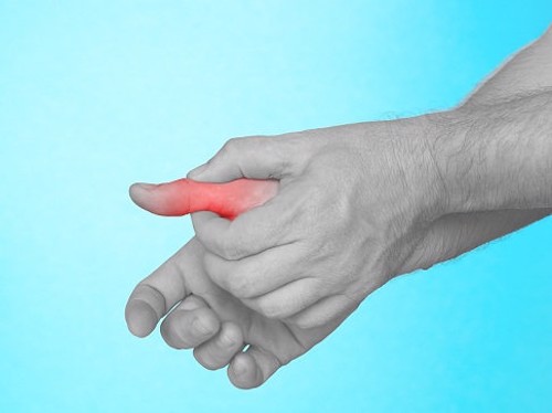 Viêm khớp ngón cái có nguy cơ biến chứng không và nên điều trị như thế nào?