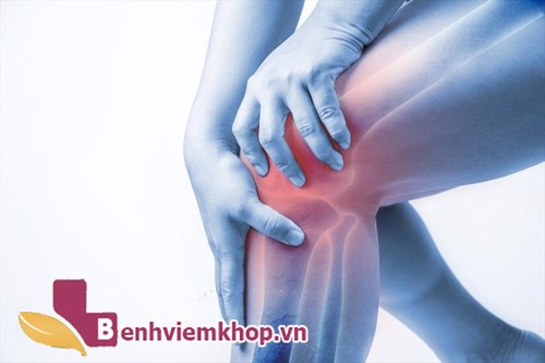 Người bị VIÊM KHỚP GỐI kiêng ăn gì? – Ghi nhớ ngay 6 thực phẩm cần tránh xa!