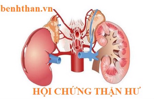 Hội chứng thận hư có nguy hiểm không? Cải thiện bằng Ích Thận Vương có hiệu quả?