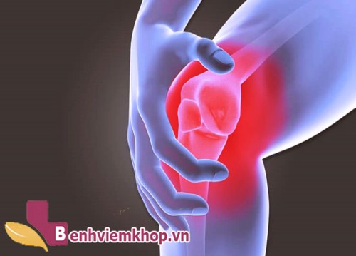 Tại sao người bị đau khớp gối khi trời lạnh nên dùng Hoàng Thấp Linh?