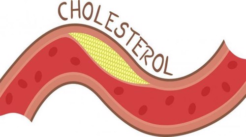 Có phải khi cholesterol cao là có vấn đề về tim mạch? Chuyên gia Nguyễn Thị Hương giải đáp