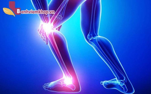 Tìm hiểu về bệnh VIÊM KHỚP CHÂN và những thông tin hữu ích dành cho bạn