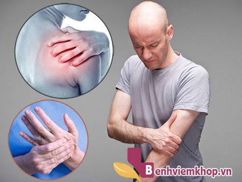  Đau nhức xương khớp: Nguyên nhân và biện pháp khắc phục hiệu quả, an toàn