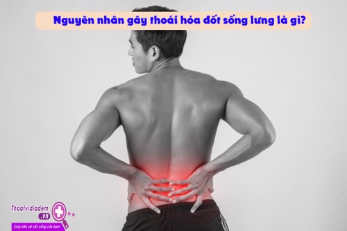 GHI NHỚ NGAY: Thoái hóa đốt sống lưng và cách điều trị 