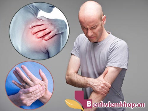 4 lý do người mắc bệnh VIÊM KHỚP nên lựa chọn Hoàng Thấp Linh hỗ trợ điều trị